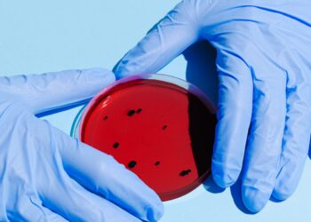 NIH won’t rule out that Covid-19 originated from lab