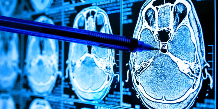 Using Machine Learning to Identify Undiagnosable Cancers - CEO North America Using Machine Learning to Identify Undiagnosable Cancers