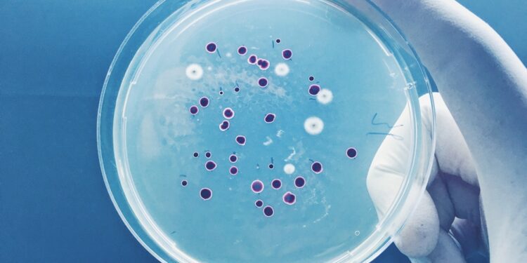 Methane-absorbing bacteria could slow global heating - CEO North America Methane-absorbing bacteria could slow global heating