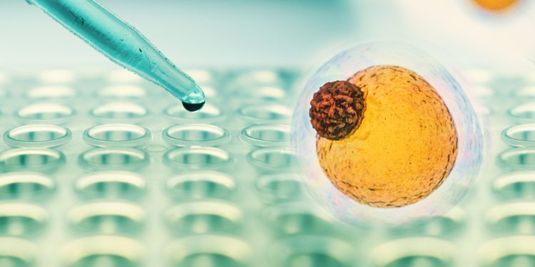 Fat Cells Retain a ‘Memory’ of Obesity, Making It Hard to Lose Weight and Keep It Off, Study Suggests - CEO North America Fat Cells Retain a ‘Memory’ of Obesity, Making It Hard to Lose Weight and Keep It Off, Study Suggests